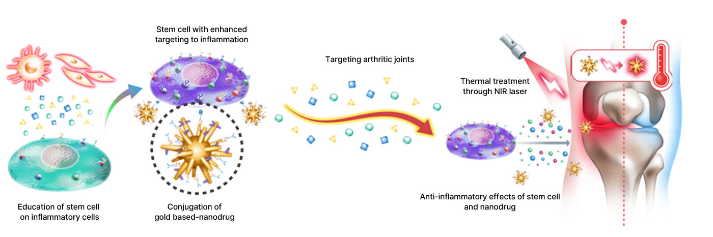 Inflammation targeting stem cells - nanodrug combination therapy